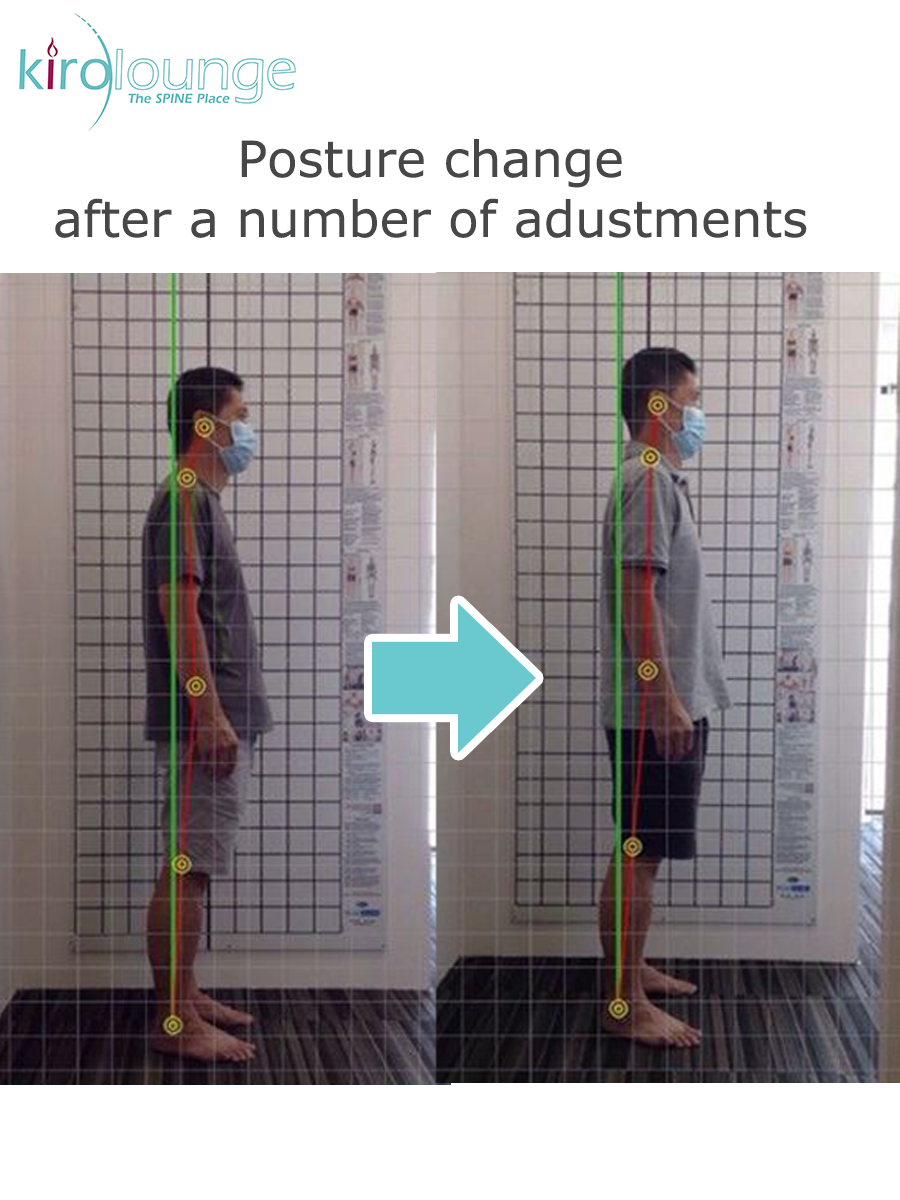 Posture correction