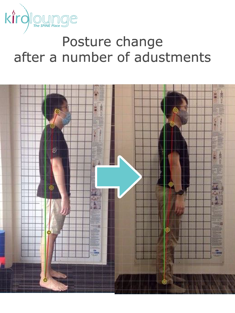 Posture correction