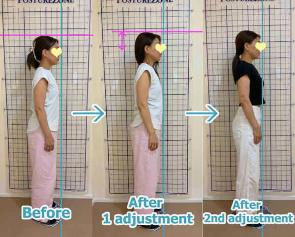 posture improvement