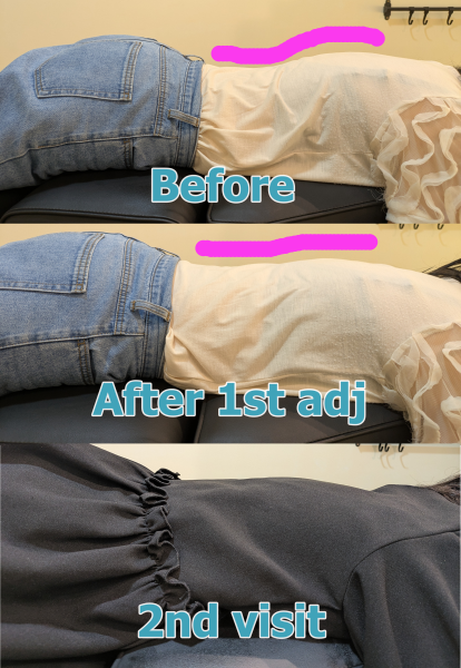posture improvement